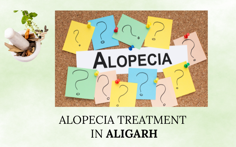 Alopecia Treatment in Aligarh
