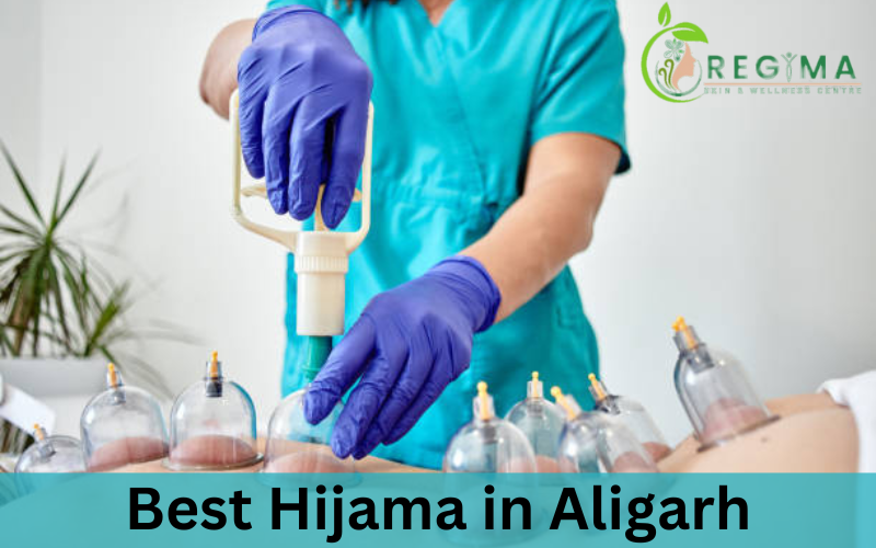 hijama in aligarh