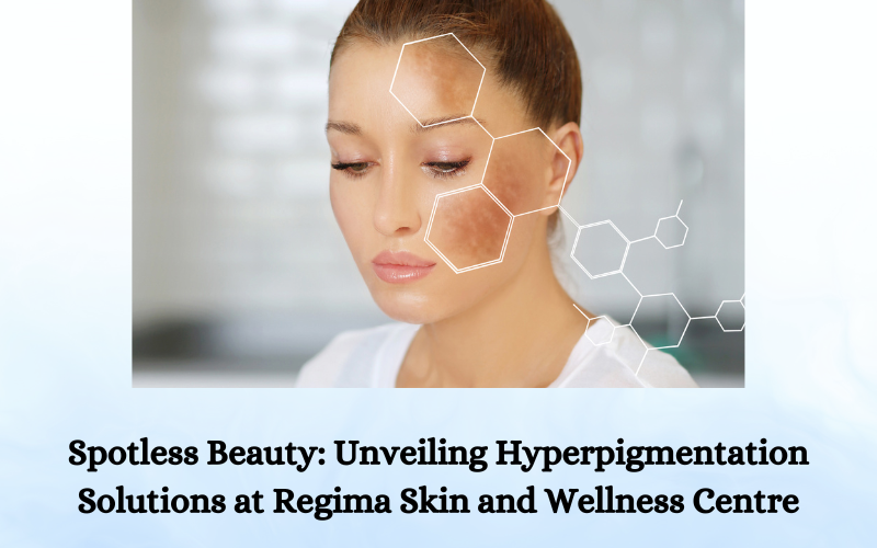 Hyperpigmentation Treatment