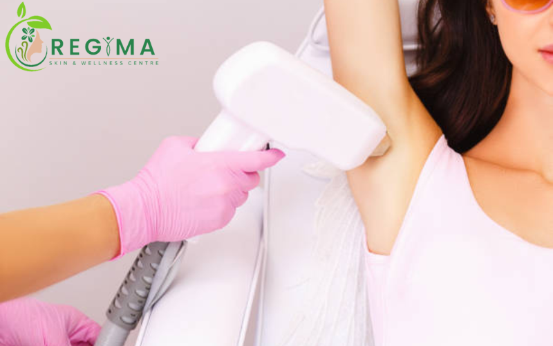 laser hair removal in aligarh 1